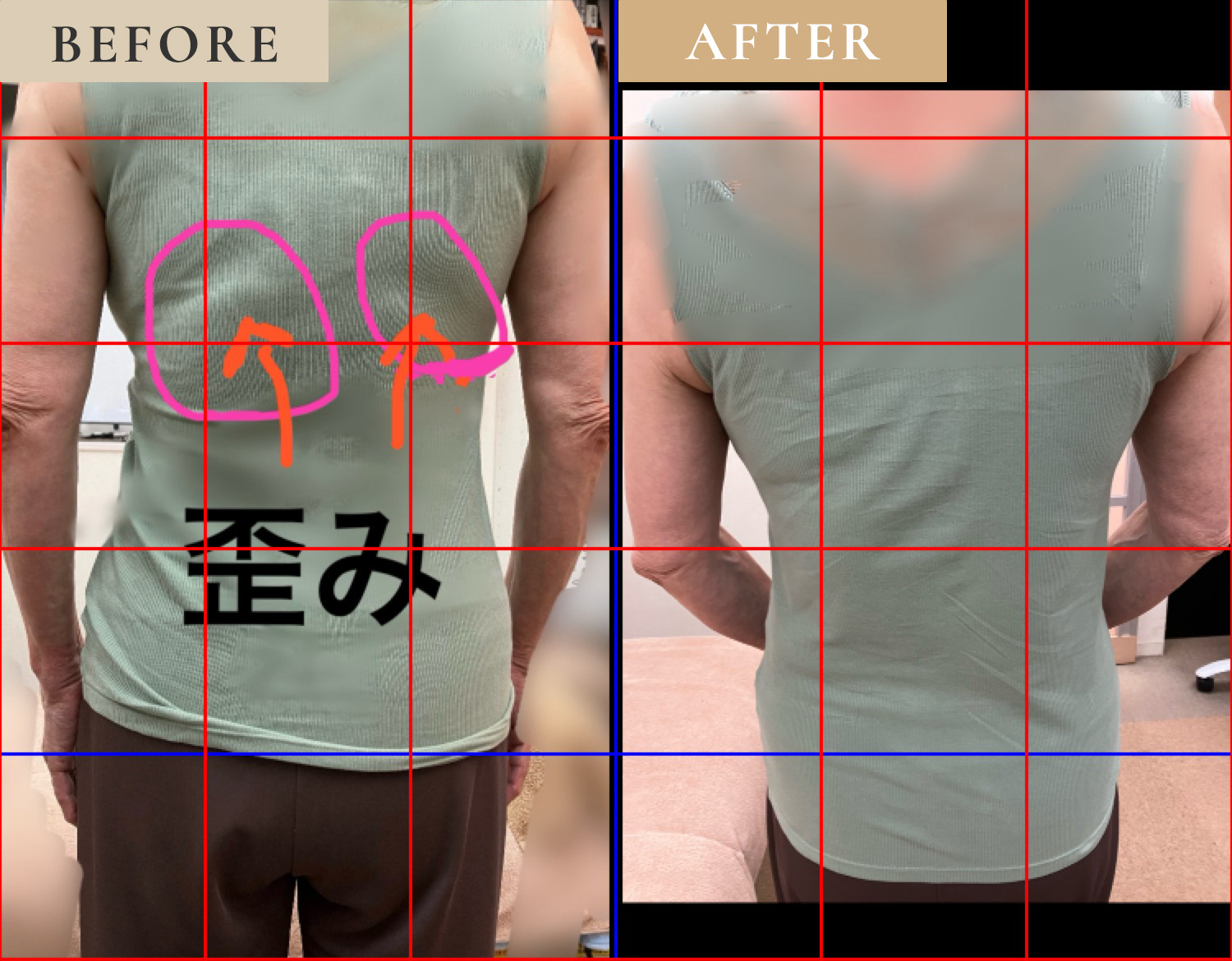ビフォーアフター