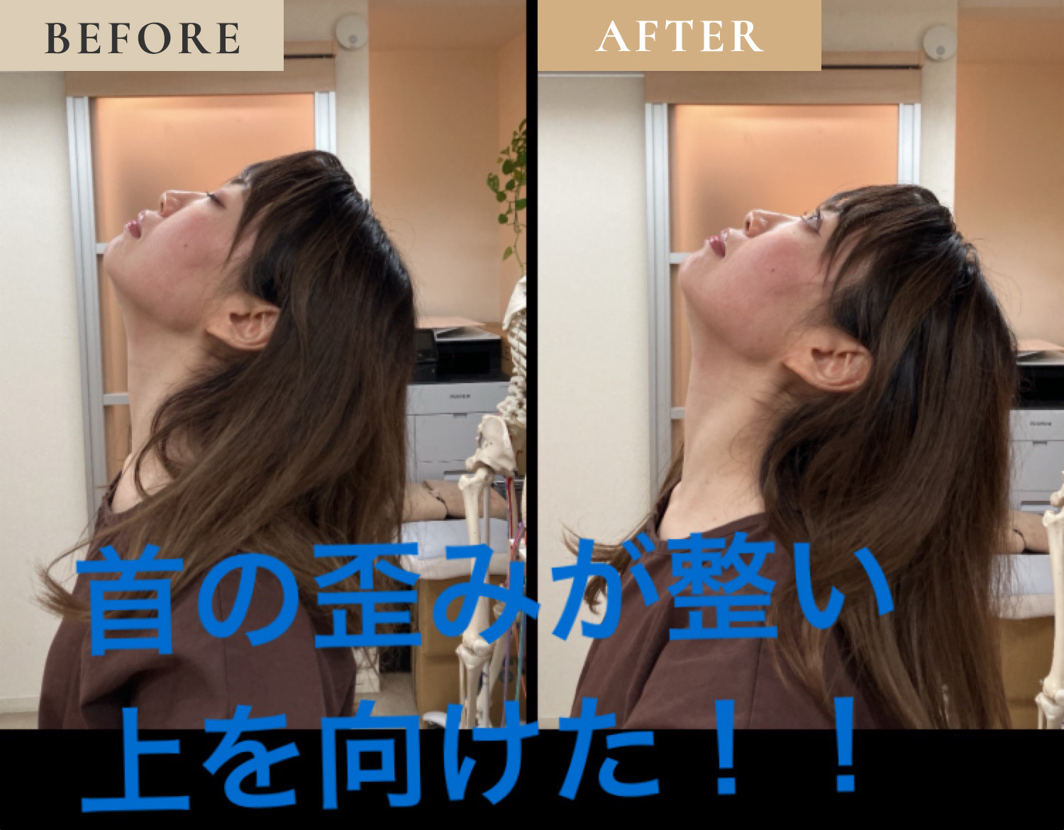 ビフォーアフター