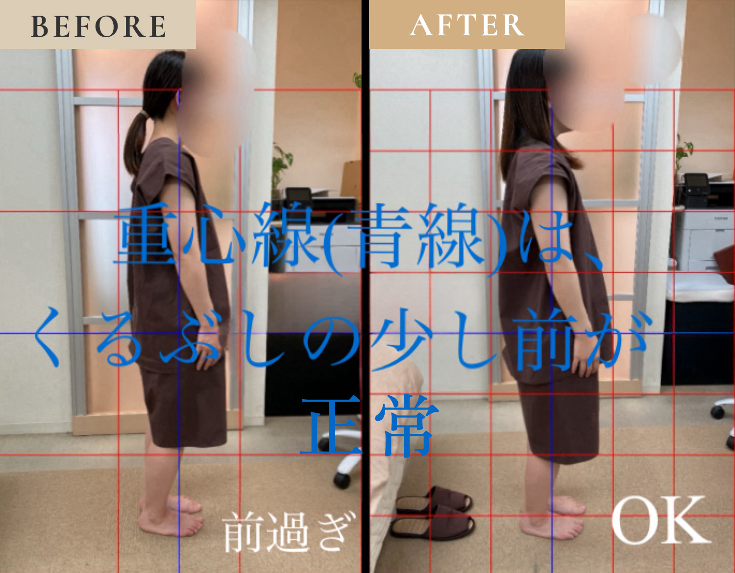 ビフォーアフター